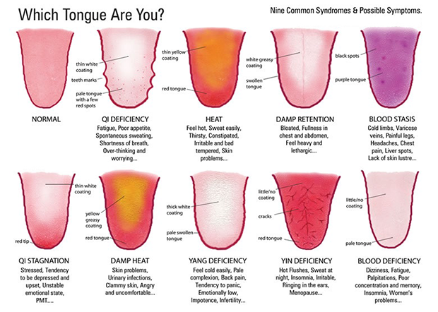 9 Surprising Secrets Your Tongue Can Reveal About Your Health 